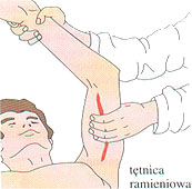tetnica_ramieniowa